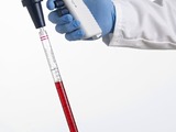 UltraJet electronic pipette filler from Porvair Sciences