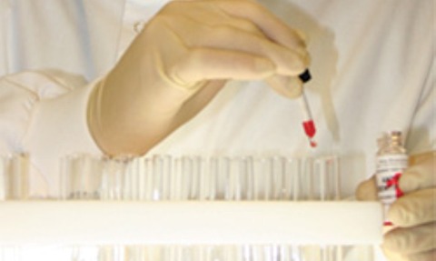 Blood reagent kits