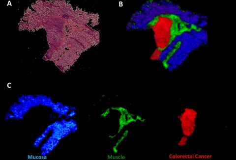 Chemical reconstruction of tissue regions