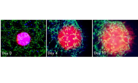 In the Amsbio application report, a novel 3D spheroid triculture model for evaluating breast cancer 