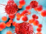 New technology developed to diagnose cancer cells