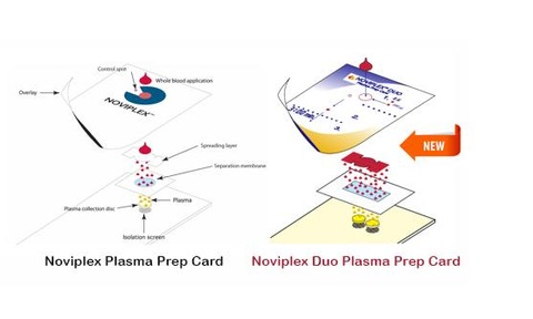 The Noviplex Duo prepares a blood sample anytime and anywhere