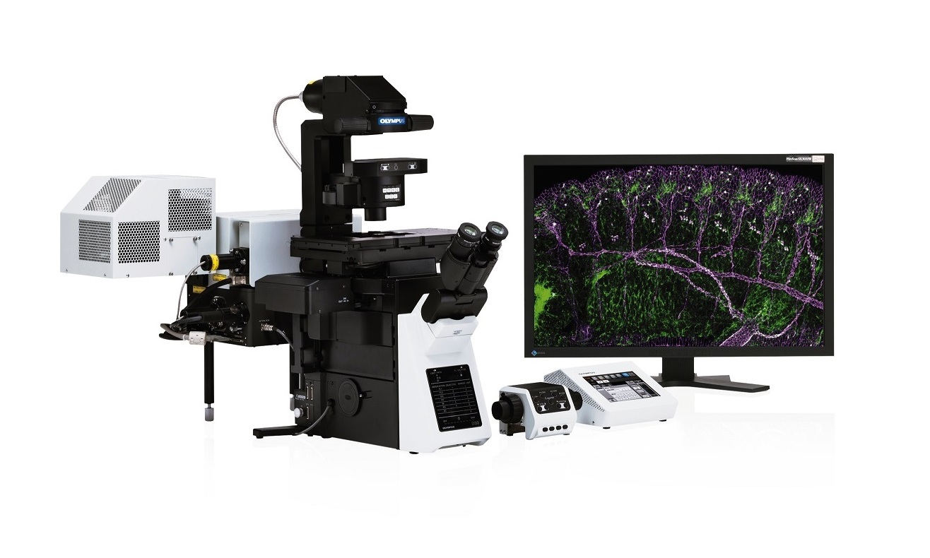 Software solution for super resolution | Laboratory Talk