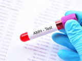 Access AMH Advanced helps clinicians predict poor ovarian response