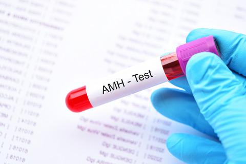 Access AMH Advanced helps clinicians predict poor ovarian response