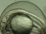 Zebrafish embryo