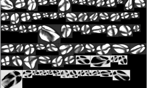 ImagePotato Starch Imaged with Birefringence FlowCAM