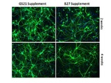 Improving Overall Growth & Performance of Primary Neurons