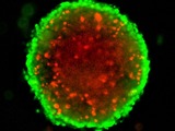 3D cancer screening assays