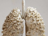 Lungs