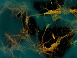 Neurons attached to a scaffold