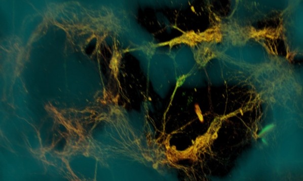 Neurons attached to a scaffold