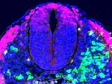 Lab grows spinal cord 'seed' for first time