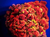 HIV-infected H9 T Cell