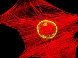 Mesenchymal stem cells