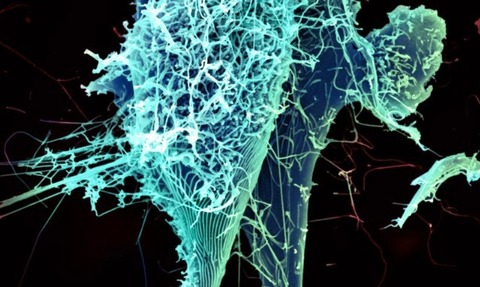 Ebola virus particles