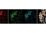 Clusters of Human Embryonic Stem Cells 