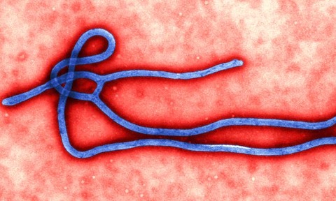 Ebola virus