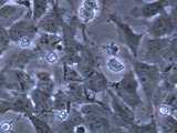 Neural stem cells