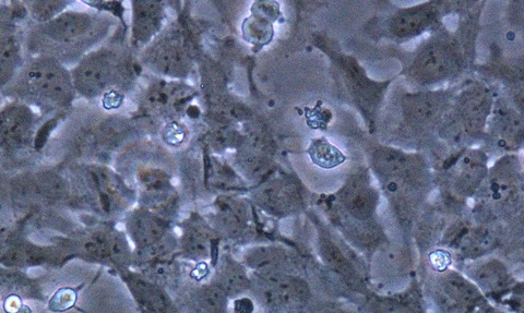 Neural stem cells