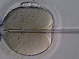 IVF