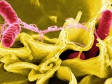 Salmonella Bacteria