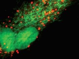 Live cell imaging of cell nucleus CellLight reagents.jpg