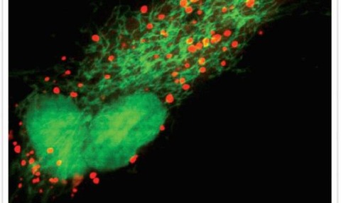 Live cell imaging of cell nucleus CellLight reagents.jpg